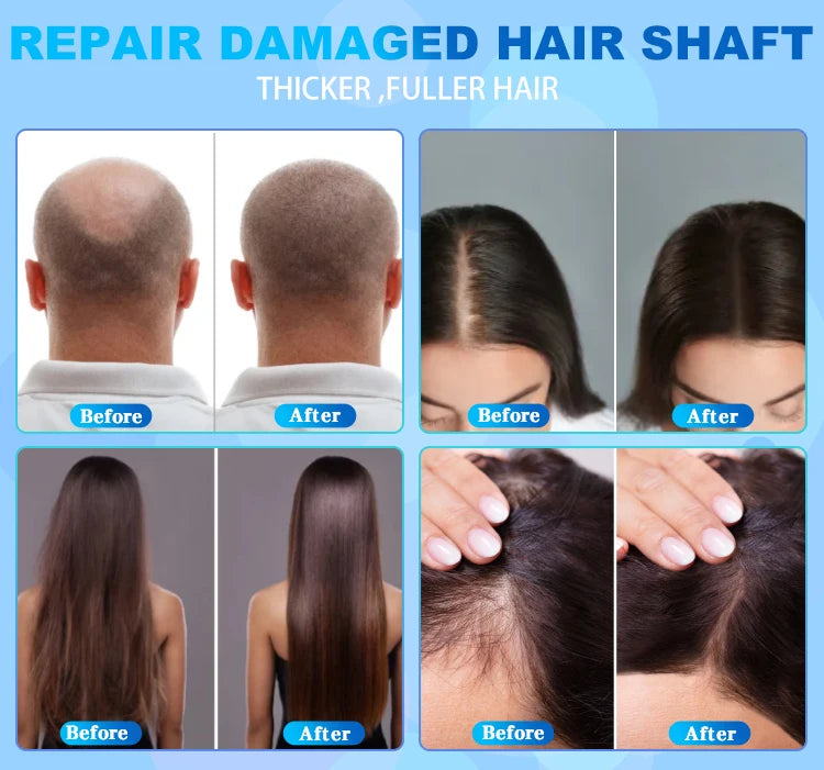 2 HD Detector 50X 200X 7 In 1 Hair Loss Treatment Analyzer Analysis And Scalp Machine With Massage Comb